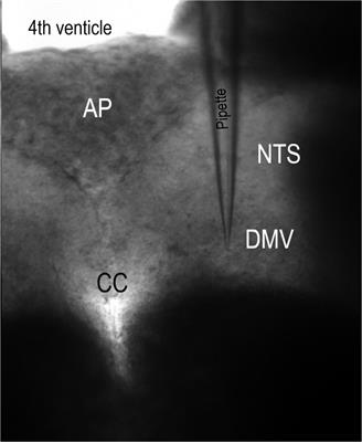 Substance P Increases the Excitability of Dorsal Motor Nucleus of the Vagus Nerve via Inhibition of Potassium Channels